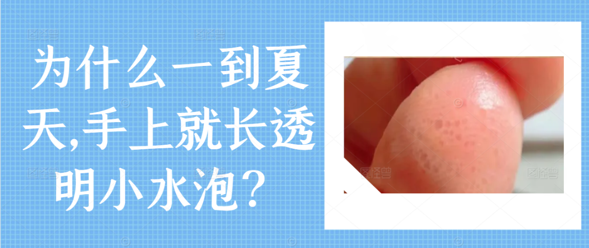 为什么一到夏天,手上就长透明小水泡